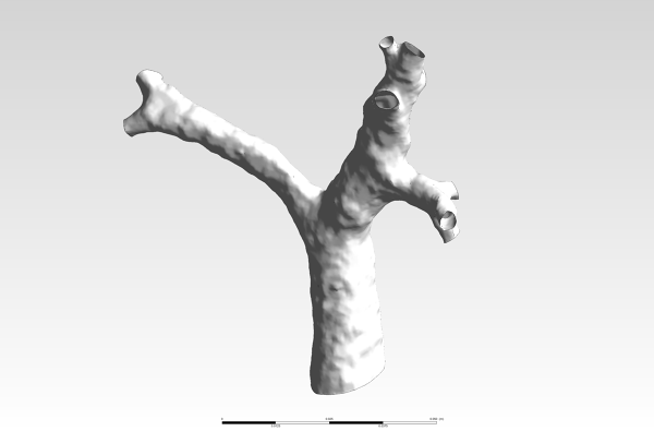 Human-Trachea-CAD-Model-FetchCFD-Image-View-2.PNG - High-quality image for the Human Trachea CAD project