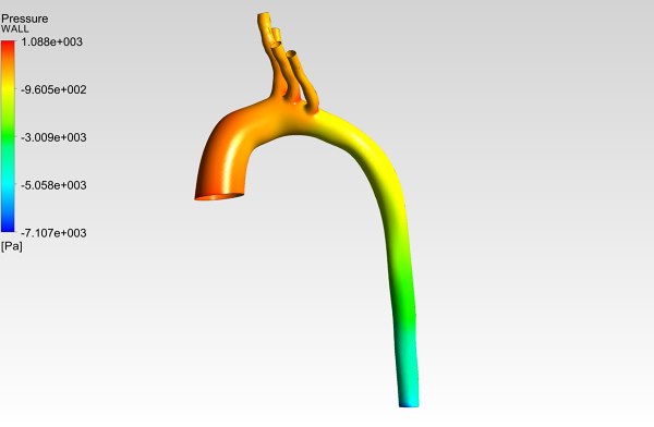 Human-Aortic-Arch-0075-1001-CFD-Analysis-Pressure-Contour-FetchCFD-Image.PNG - High-quality image for the Patient-Specific Aortic Arch CFD Analysis project