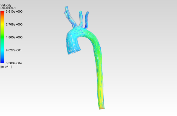 Human-Aortic-Arch-0075-1001-CFD-Analysis-Velocity-Streamlines-FetchCFD-Image.PNG - High-quality image for the Patient-Specific Aortic Arch CFD Analysis project