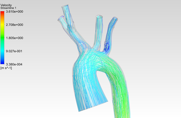 Human-Aortic-Arch-0075-1001-CFD-Analysis-Velocity-Streamlines-FetchCFD-Image-Zoomed-In.PNG - High-quality image for the Patient-Specific Aortic Arch CFD Analysis project