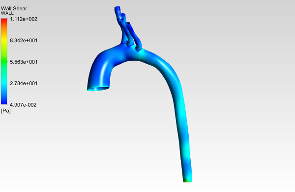 Human-Aortic-Arch-0075-1001-CFD-Analysis-Wall-Shear-Stress-Contour-FetchCFD-Image.PNG - High-quality image for the Patient-Specific Aortic Arch CFD Analysis project