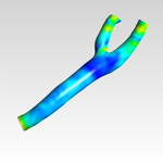 Preview of the original project Carotid Bifurcation CFD Analysis - Explore this CFD Simulation on FetchCFD
