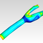 Carotid bifurcation cfd simulation