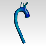 Human Aortic Arch CFD Analysis