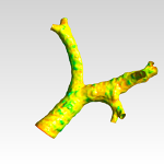 Human Trachea CFD Analysis