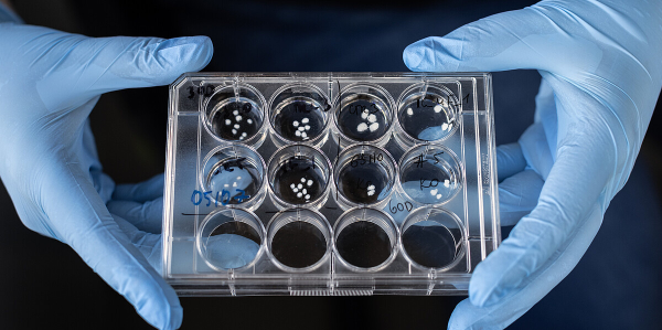 30 und 60 Tage alte Hirn-Organoide in der Petrischale