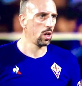 Ribery In Fiorentina Napoli 2019 20 51