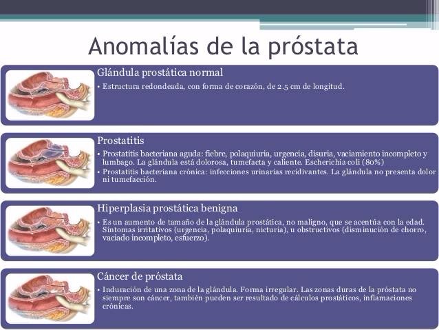 Cuando tiene un absceso perianal, tiene un dolor anke en la próstata.