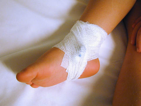 bandage