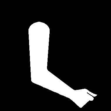arm