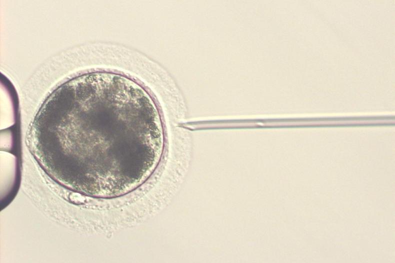 Opinion: Assisted Reproduction Techniques (ART)