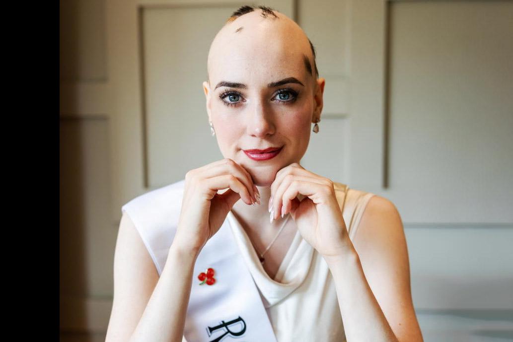 Choileann Ni Choiligh: ‘go out and rock your bald head’