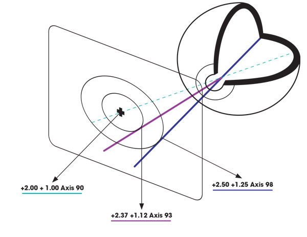Conventional Lenses diagram
