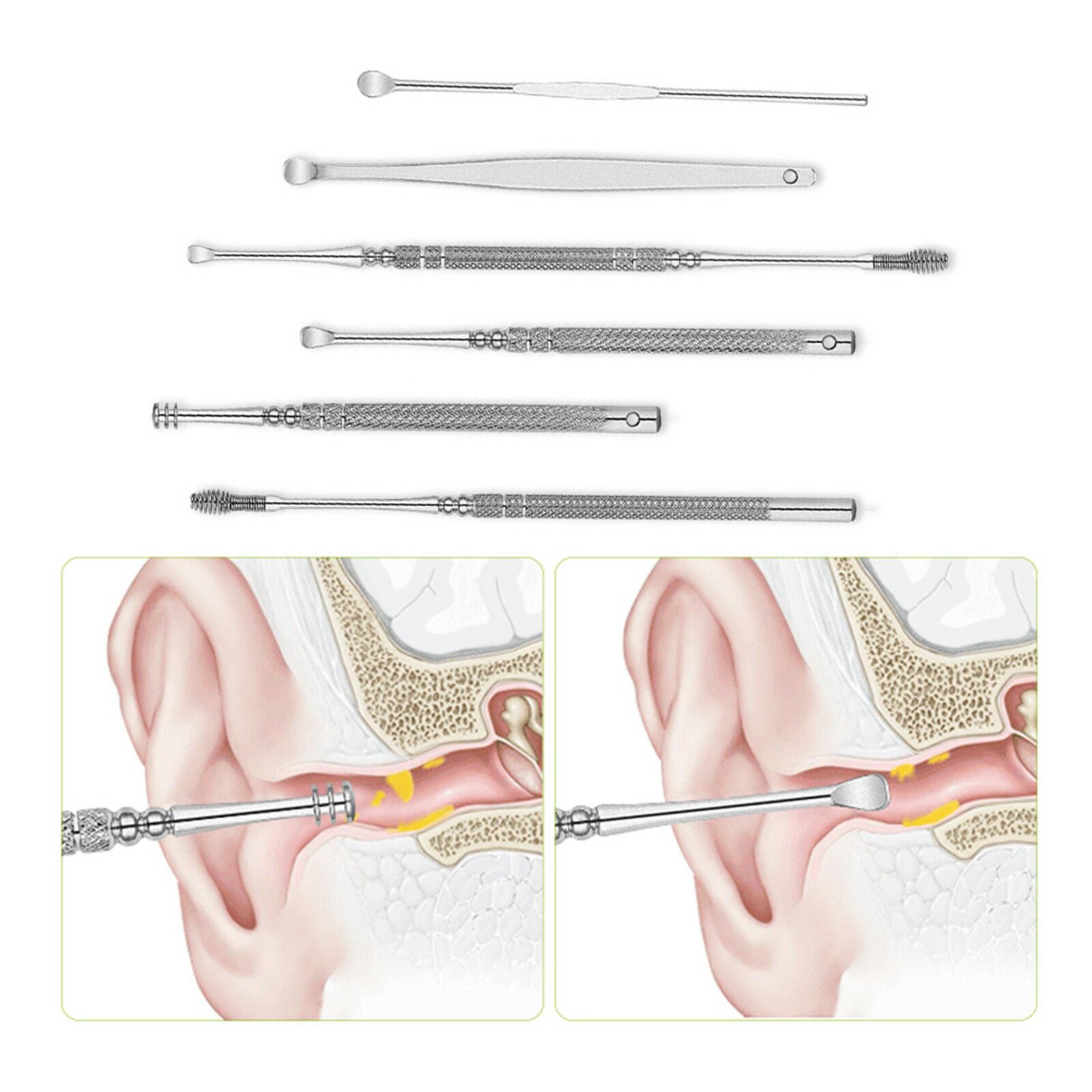 6 Piece Ear Wax Removal Kit Ear Canal Safe Cleaning Tools Stainless