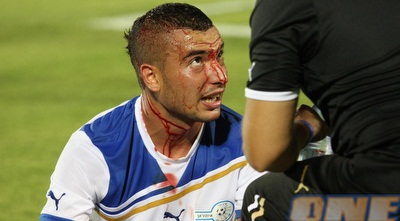 אבוחצירא מדמם לאחר התנגשות ראשים עם ליאור ז&acute;אן (עמית מצפה)