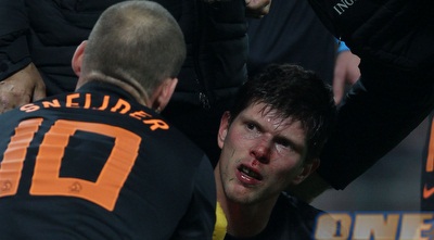 הונטלרא פגוע (GettyImages)