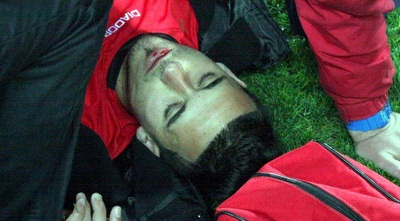 עלי חטיב שרוע על הדשא. &qout;נפל וקיבל בעיטה חזקה מאוד לפנים&qout; (משה חרמון) עלי חטיב שרוע על הדשא. &qout;נפל וקיבל בעיטה חזקה מאוד לפנים&qout; (משה חרמון)