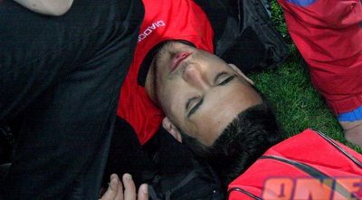 חטיב לאחר הפגיעה. המראות האלו לא שכנעו את התובע (משה חרמון)