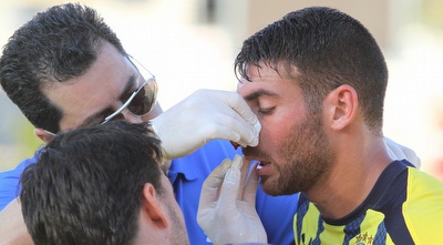 עטר מקבל טיפול באפו המדמם. הפצוע העברי (עמית מצפה)