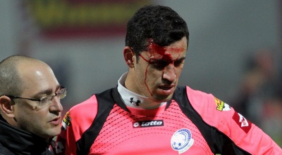 רועי לייבוביץ´ פצוע (יניב גונן)