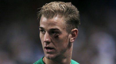 ג´ו הארט לאחר הפציעה שספג מקמרון ג´רום (רויטרס)