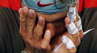 נדאל סובל מכאבים (רויטרס)