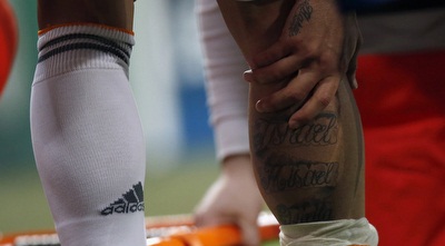 רגלו של חסה לאחר הפציעה (רויטרס)