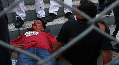 אוסבאלדו בסרה מתבוסס בדמו. כנראה שהוא לא האחרון 