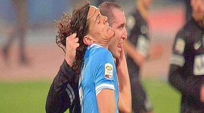 ג´ורג´יו קייליני מושך בשיערו של אדינסון קבאני ג´ורג´יו קייליני מושך בשיערו של אדינסון קבאני