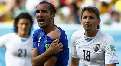 קייליני מראה את סימן הנשיכה (רויטרס) קייליני מראה את סימן הנשיכה (רויטרס)