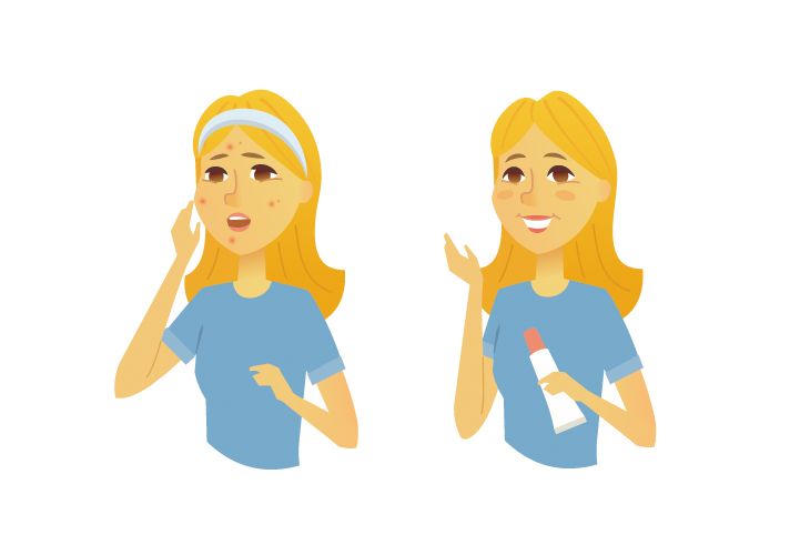 What Salicylic Acid does and Myths debunked! Pharmhealth Pharmacy What Salicylic Acid does and Myths debunked! Pharmhealth Pharmacy