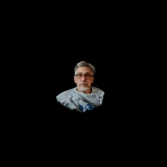 Segumiento ocular 3