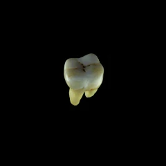 Human Molar