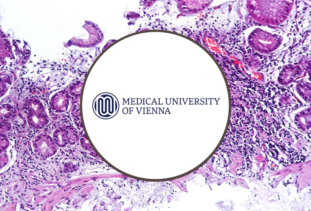 Medical University Vienna Technology Transfer - Blog Header