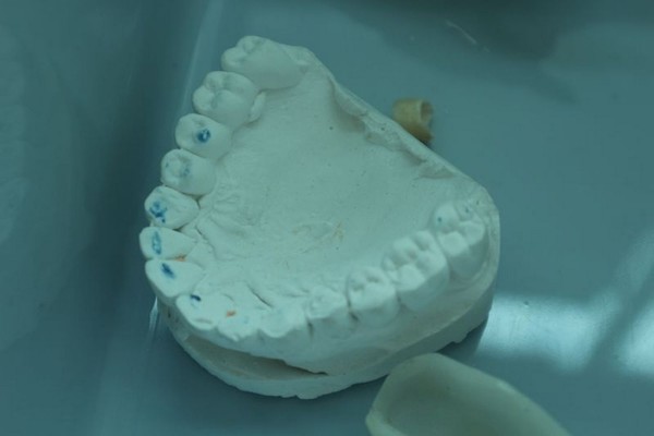 1#4922 Attrezzature e strumenti odontoiatrici in vendita - foto 412