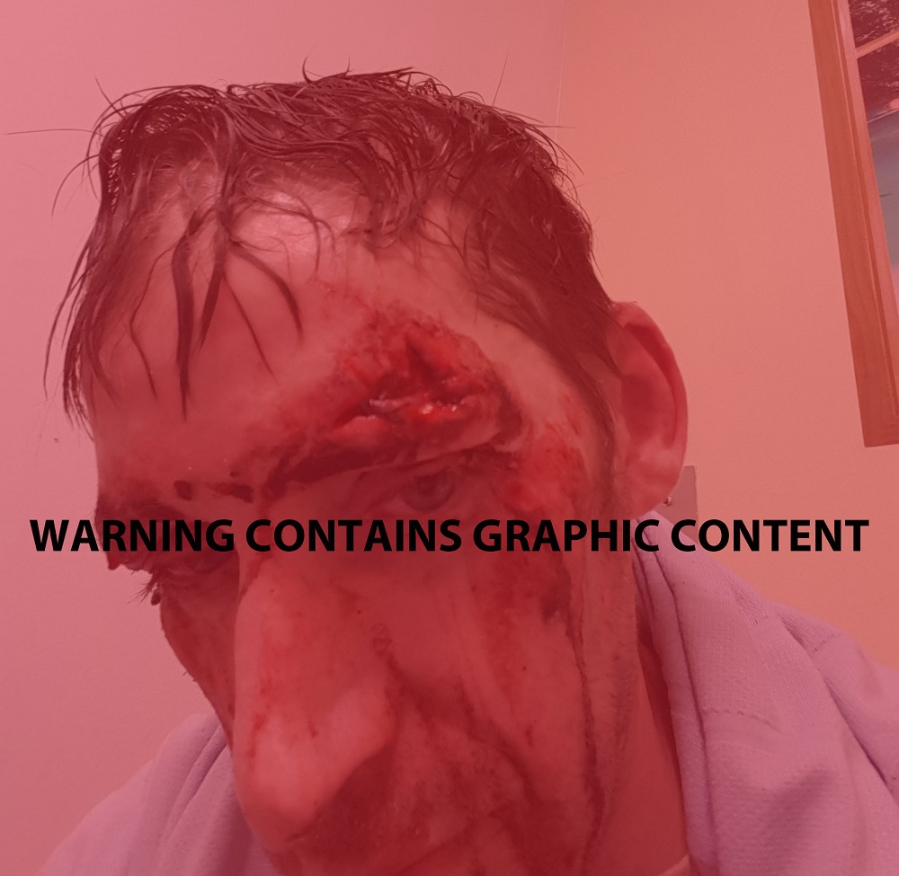 Man brutally attacked in Reading urges people to help catch attacker
