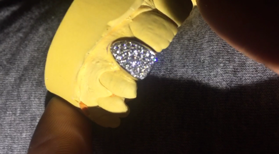 Witnesses needed after diamond tooth cap stolen from Whitley home