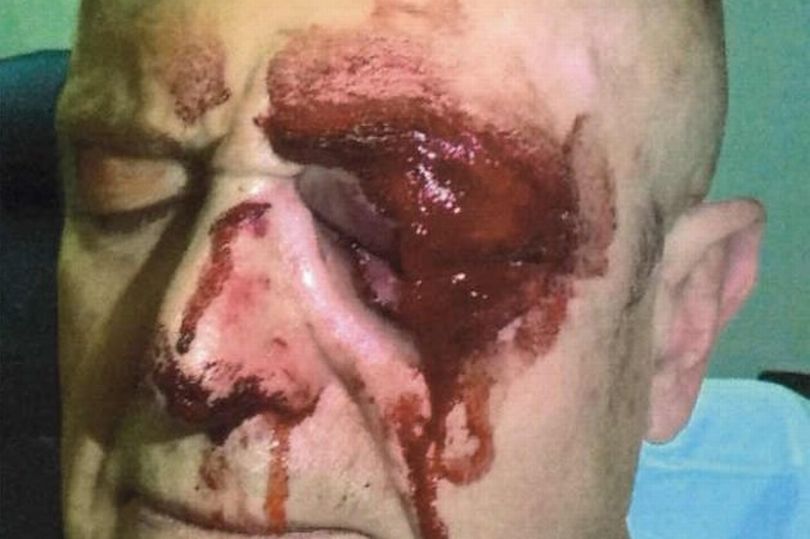 Victim is a 'bag of nerves' three months on from Caversham attack