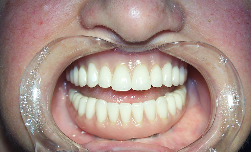 Meet-the-London-dental-clinic-bringing-back-winning-smiles-1