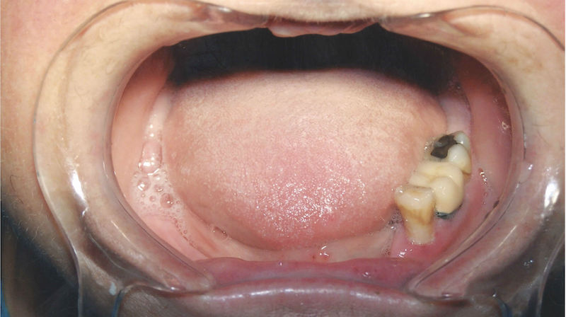 Meet-the-London-dental-clinic-bringing-back-winning-smiles-2