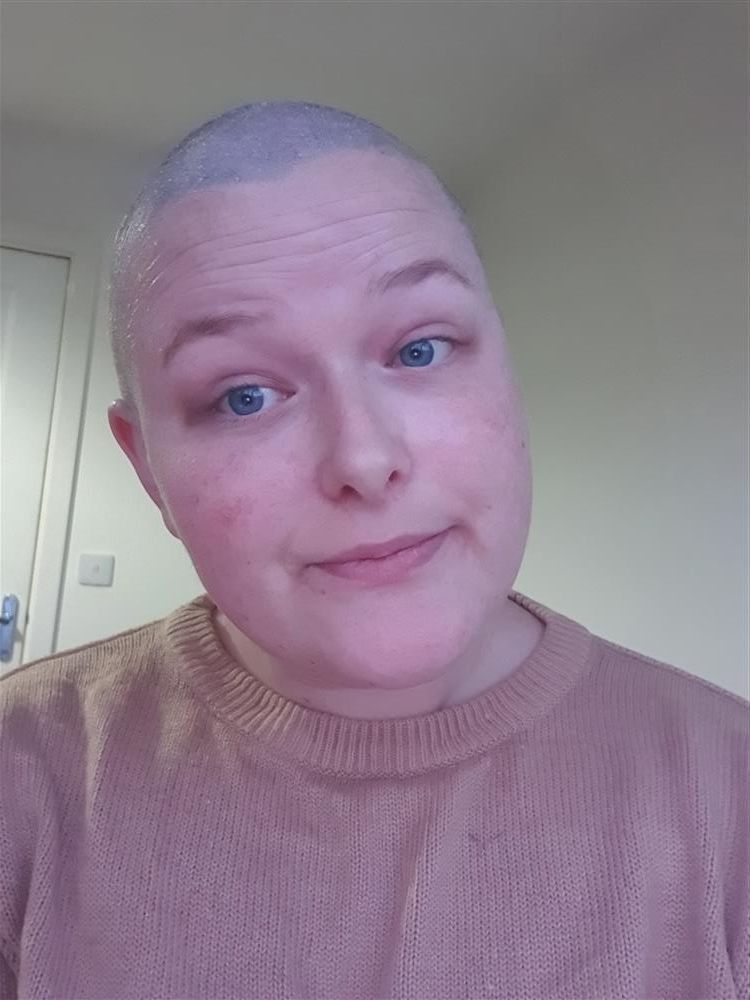 Stephanie has Sinead O'Connor haircut to raise cash for charity