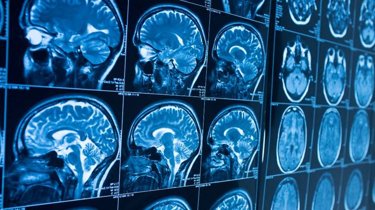 Loughborough Uni sports academic calls for concussion crisis discussion