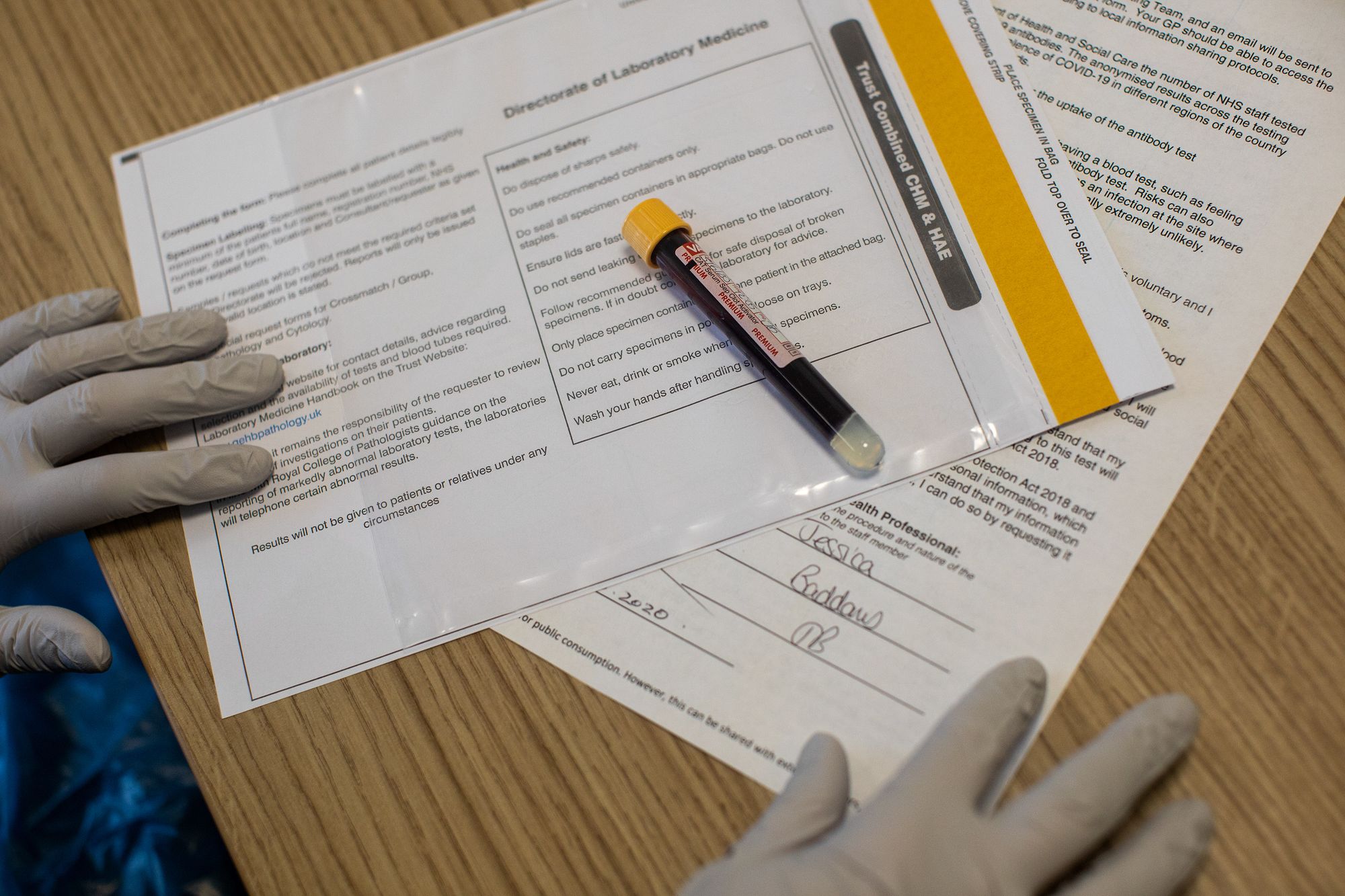 Half of people in UK now have Covid-19 antibodies