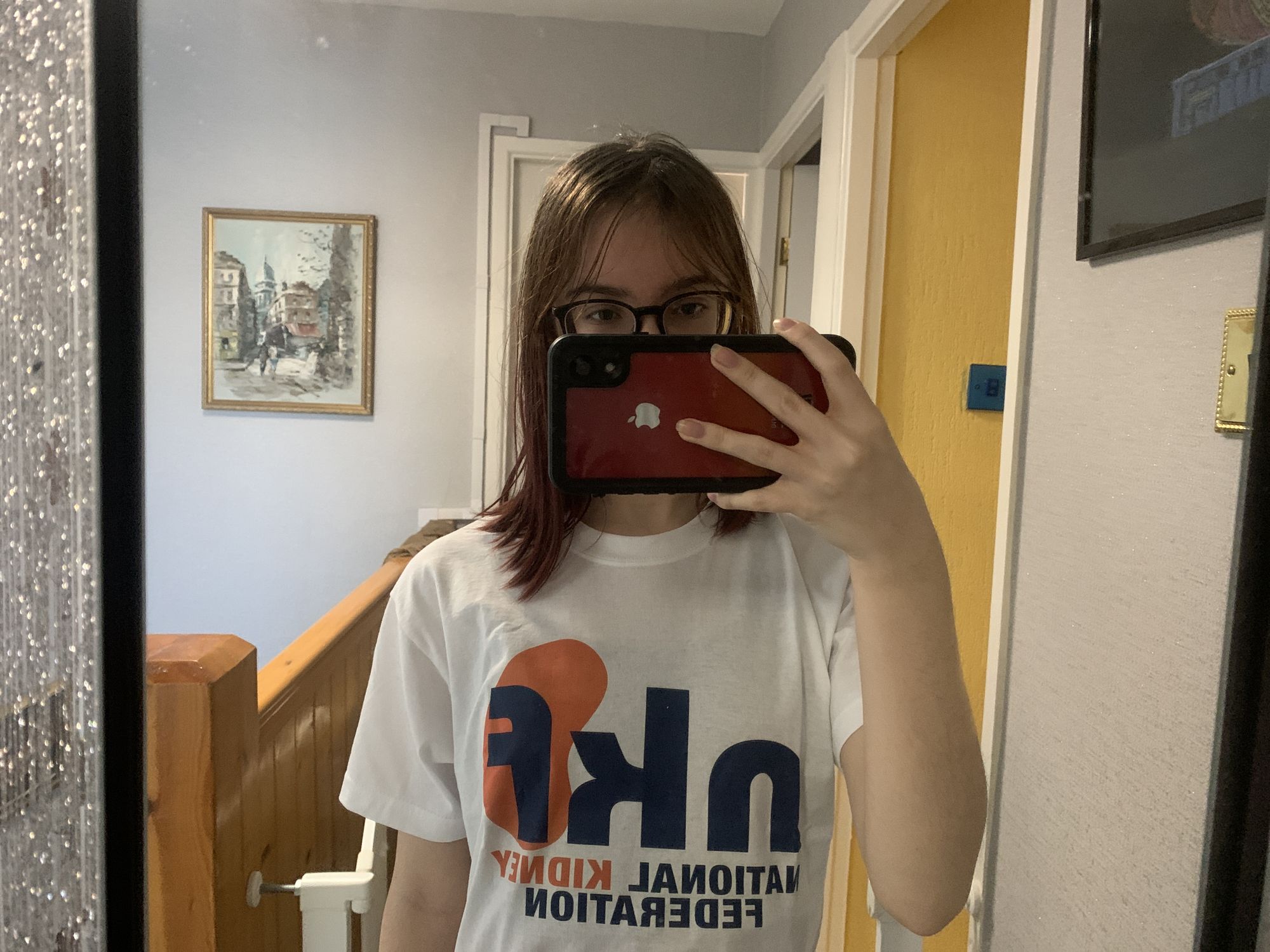 Student's sponsored shave for the National Kidney Federation