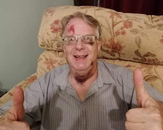 Taunton daughter steps up for charity fundraiser after father diagnosed with brain tumour