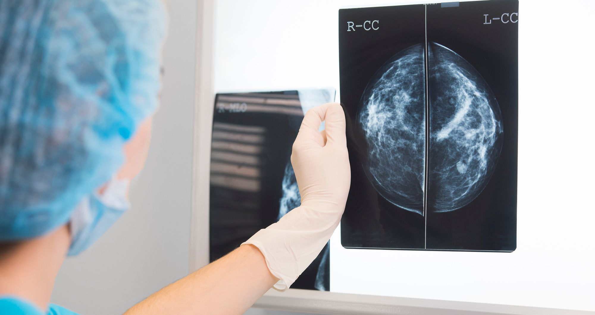 Cambridgeshire university and biotech firm land £283k for breast cancer research
