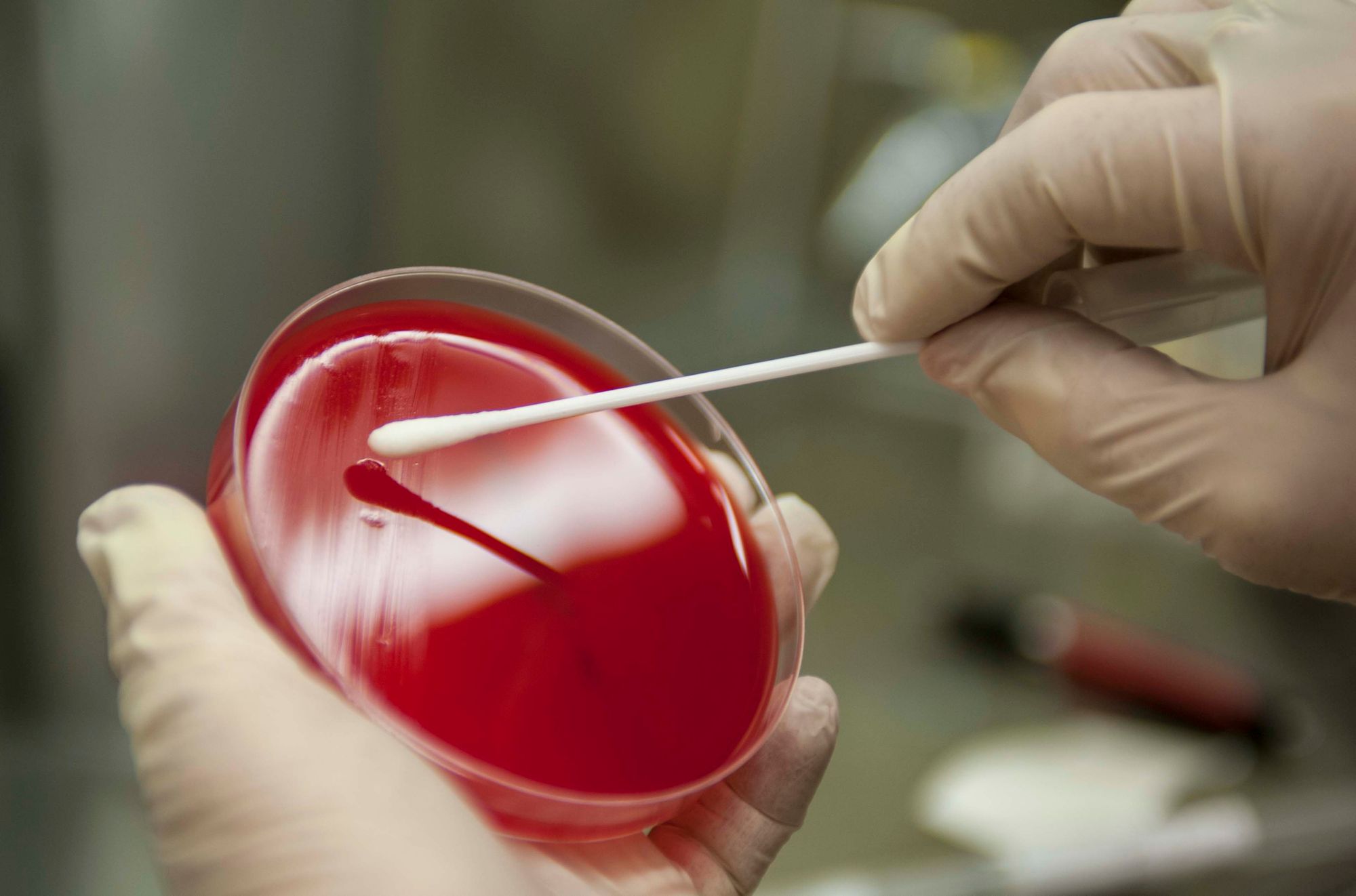 Parents urged to look out for these Strep A symptoms as ninth child dies in UK