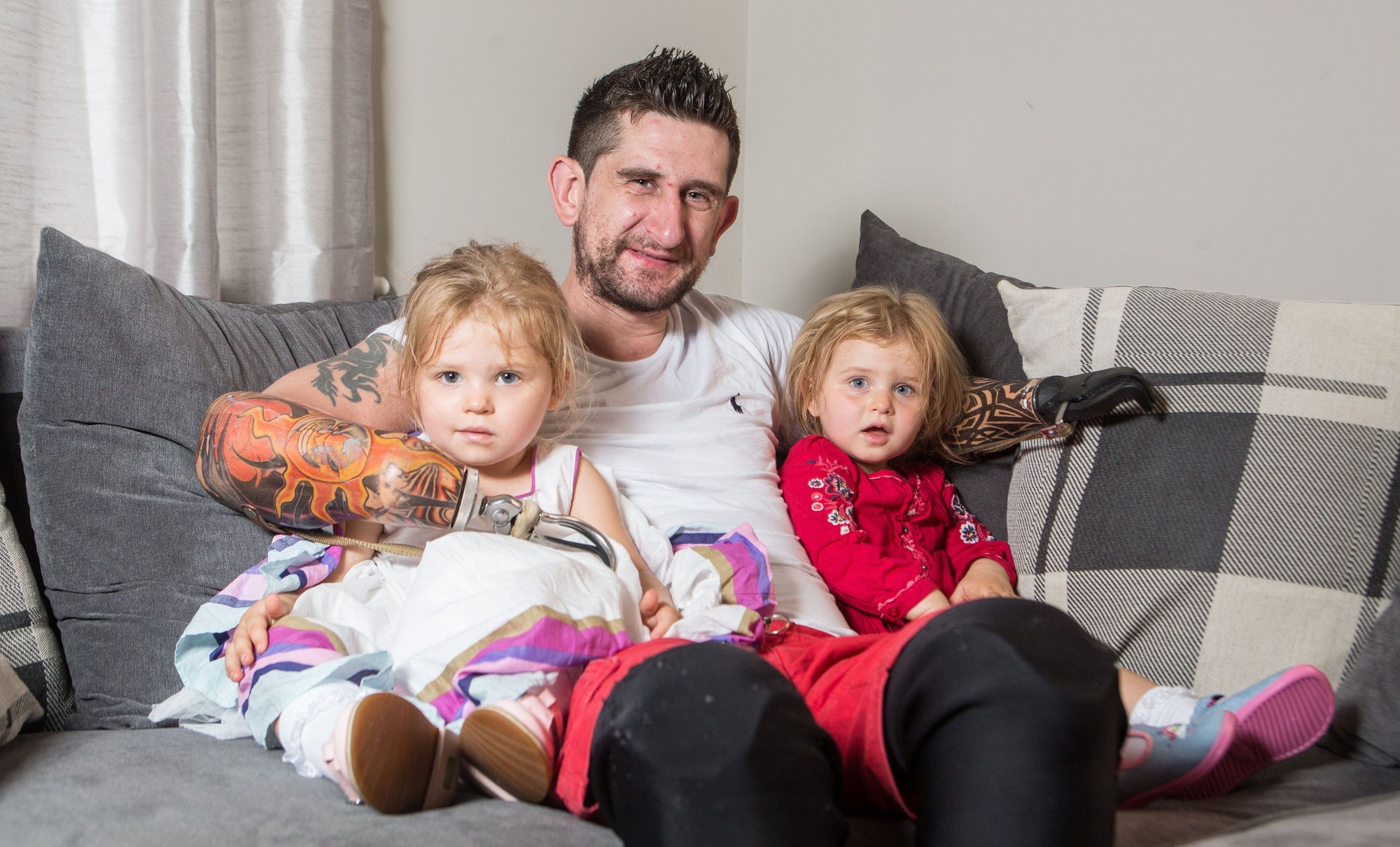 Dad who lost arms in accident can now hug daughters after double hand transplant