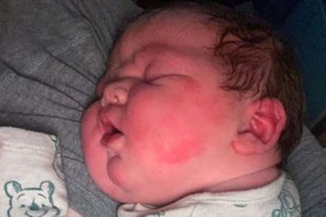 Doctors gasped after birth of 'giant' baby