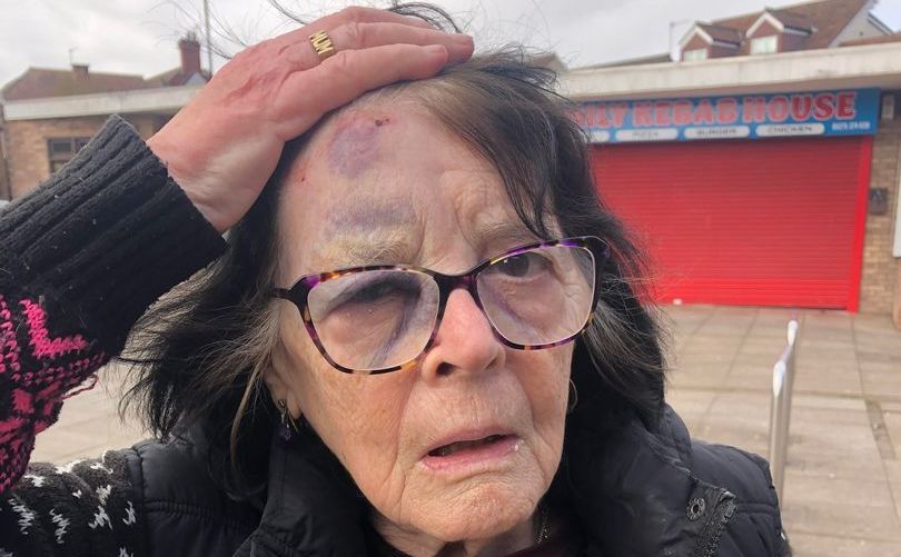 Gran left bruised after 'face-planting the floor' in hit-and-run crash with e-scooter